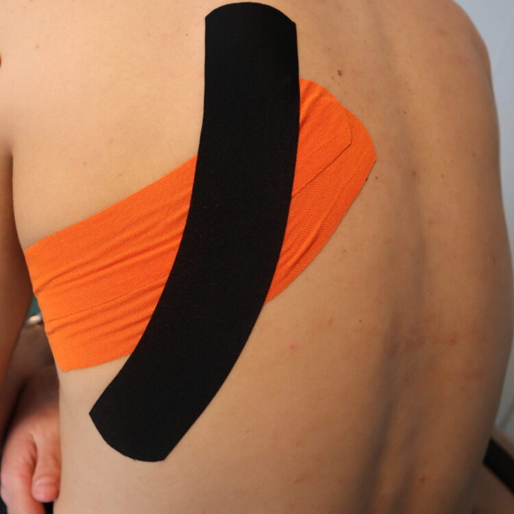 Gebroken rib